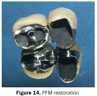 dental-sciences-restoration