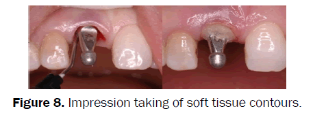 dental-sciences-soft-tissue-contours