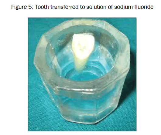 dental-sciences-solution-sodium-fluoride