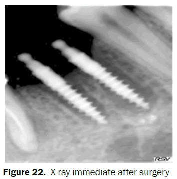 dental-sciences-surgery