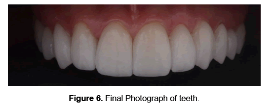 dental-sciences-teeth