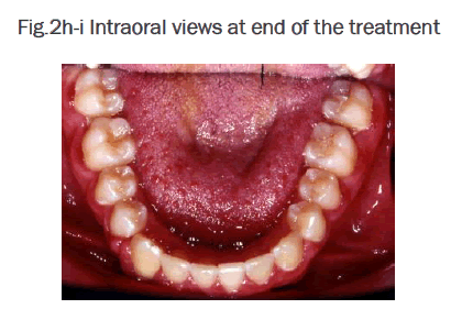 dental-sciences-views-end-treatment