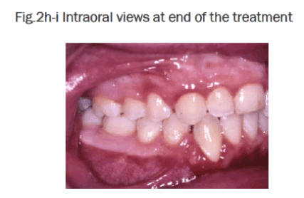 dental-sciences-views-end-treatment