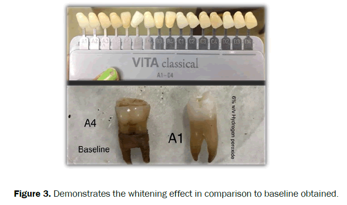 dental-sciences-whitening-baseline