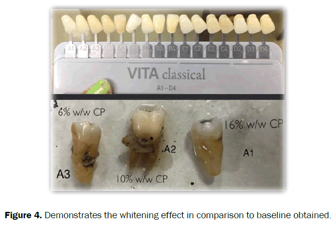 dental-sciences-whitening-baseline