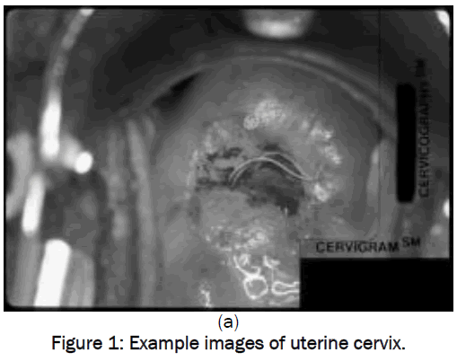 engineering-technology-Example-images-uterine-cervix