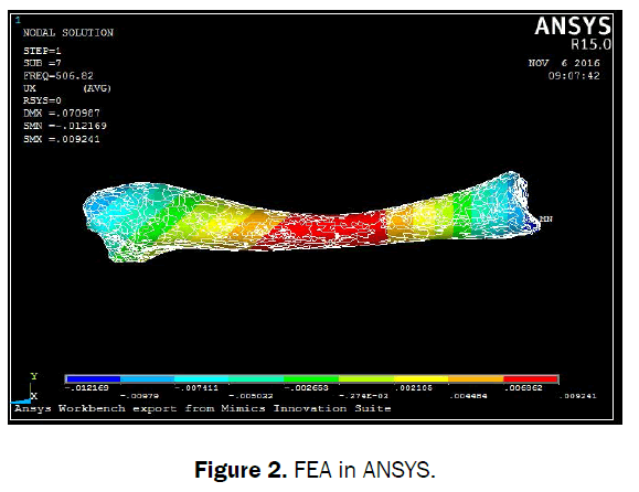 engineering-technology-fea-ansys