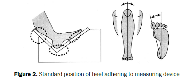 food-and-dairy-technology-heel-adhering