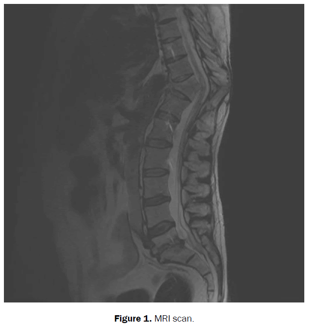 health-sciences-MRI-scan