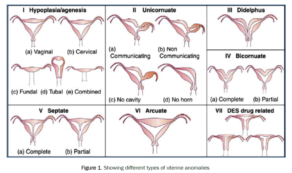 health-sciences-uterine-anomalies