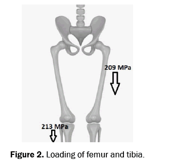 material-sciences-femur