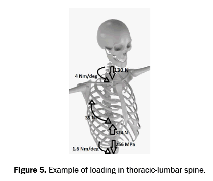 material-sciences-thoracic-lumbar