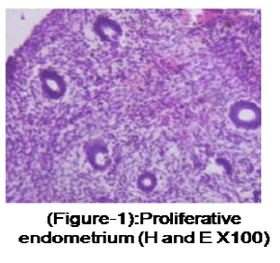 medical-and-health-sciences-Proliferative-endometrium