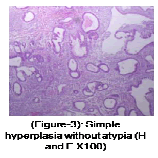 medical-and-health-sciences-Simple-Hyperplasia