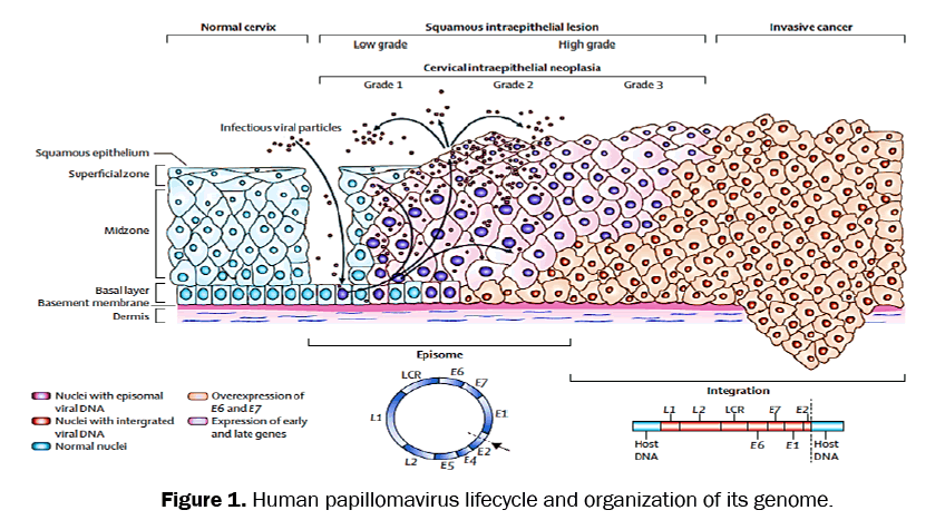 medical-clinical-oncology-Human-papillomavirus