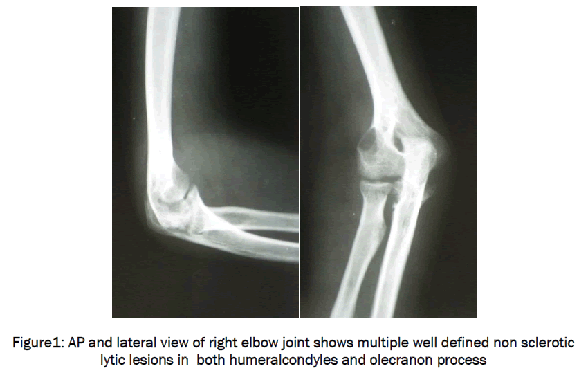 medical-health-sciences-AP-lateral-view-right-elbow