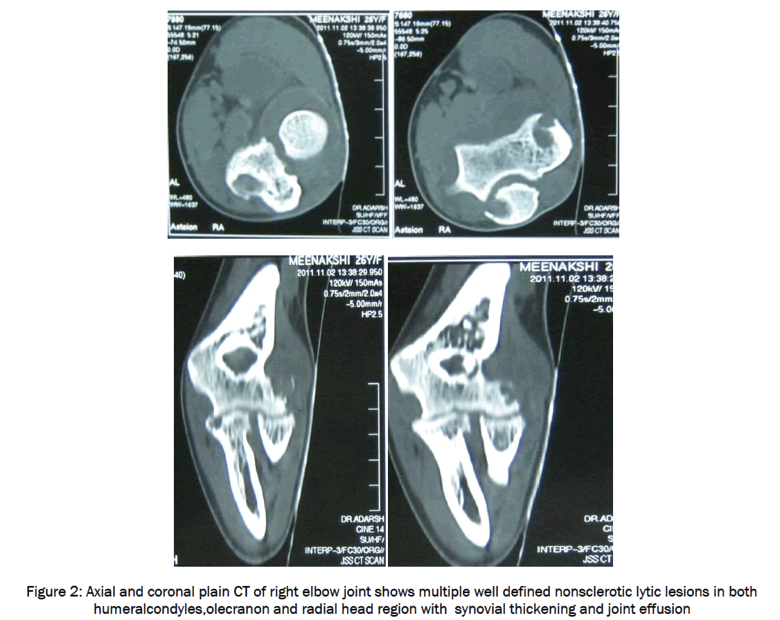 medical-health-sciences-Axial-coronal-plain-CT