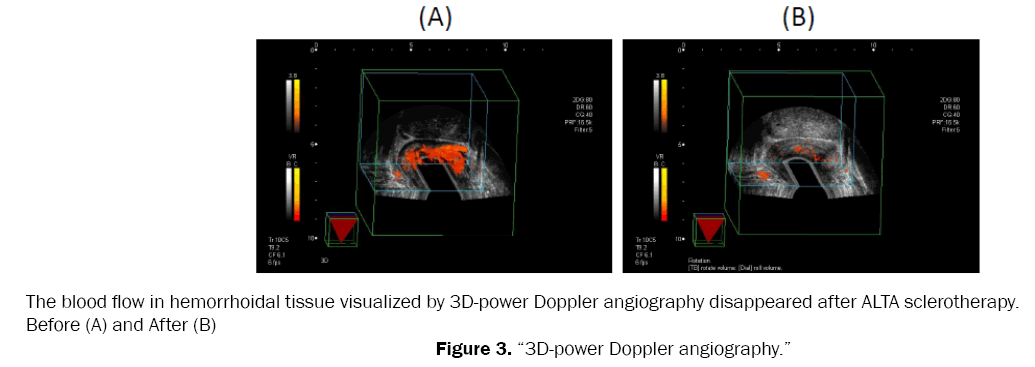 medical-health-sciences-Doppler-angiography