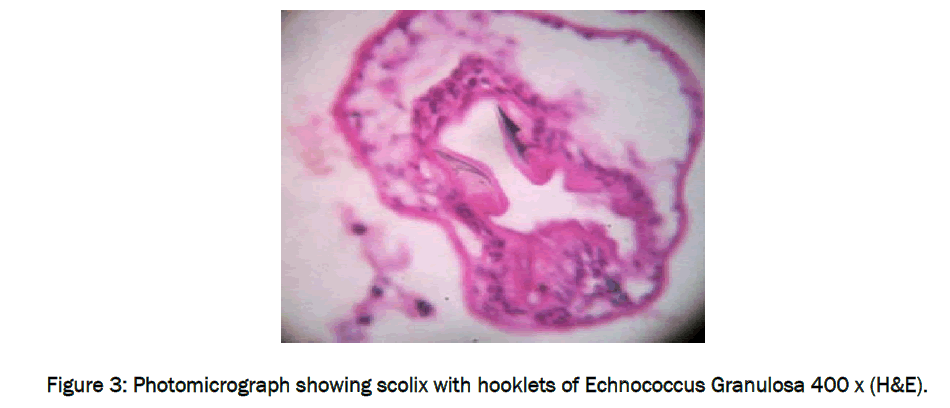 medical-health-sciences-Echnococcus-Granulosa