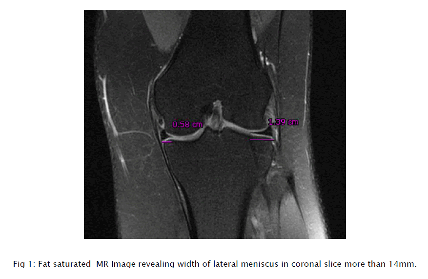 medical-health-sciences-Fat-saturated-MR-Image