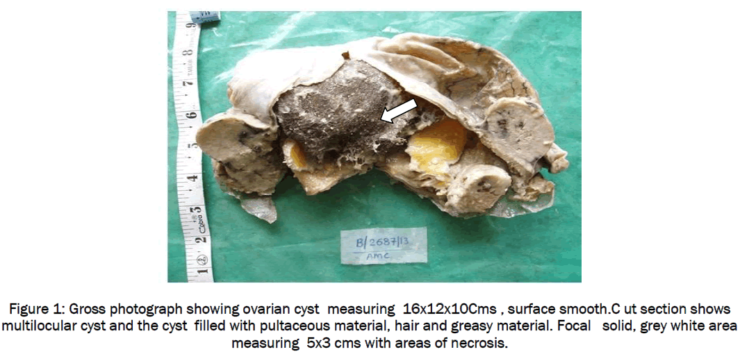 medical-health-sciences-Gross-photograph-showing-ovarian