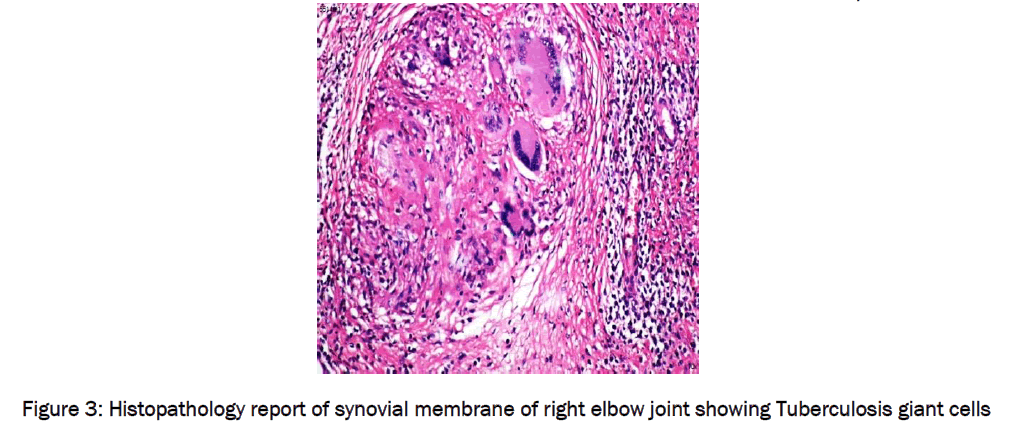 medical-health-sciences-Histopathology-report-synovial