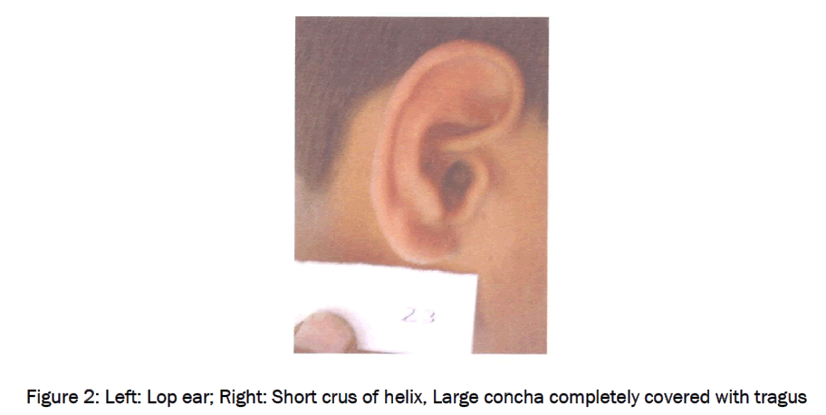 medical-health-sciences-Left-Lop-ear-Right