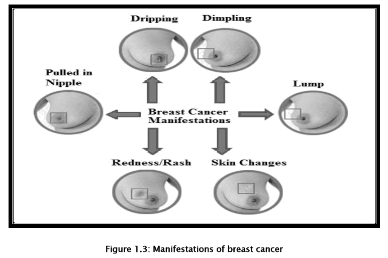 medical-health-sciences-Manifestations-breast-cancer