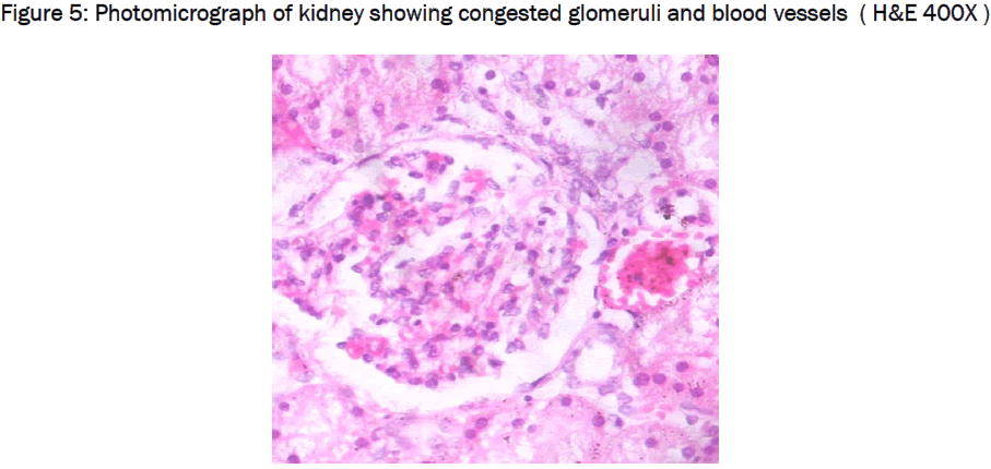 medical-health-sciences-Photomicrograph-kidney-congested