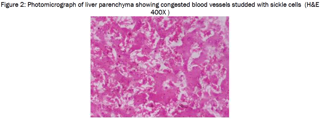 medical-health-sciences-Photomicrograph-liver-parenchyma