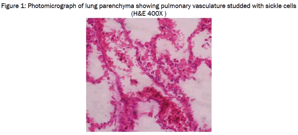 medical-health-sciences-Photomicrograph-lung-parenchyma