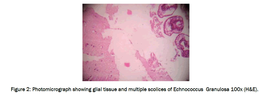 medical-health-sciences-Photomicrograph-showing
