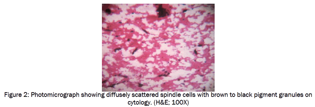 medical-health-sciences-Photomicrograph-showing-diffusely