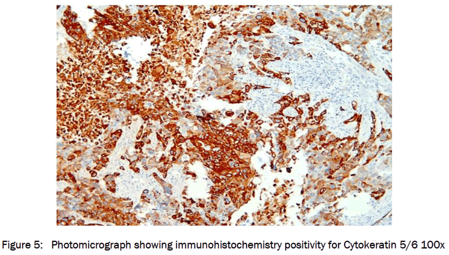 medical-health-sciences-Photomicrograph-showing-immunohistochemistry