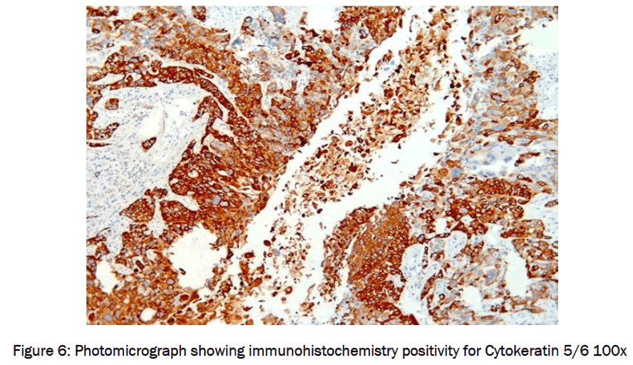 medical-health-sciences-Photomicrograph-showing-immunohistochemistry
