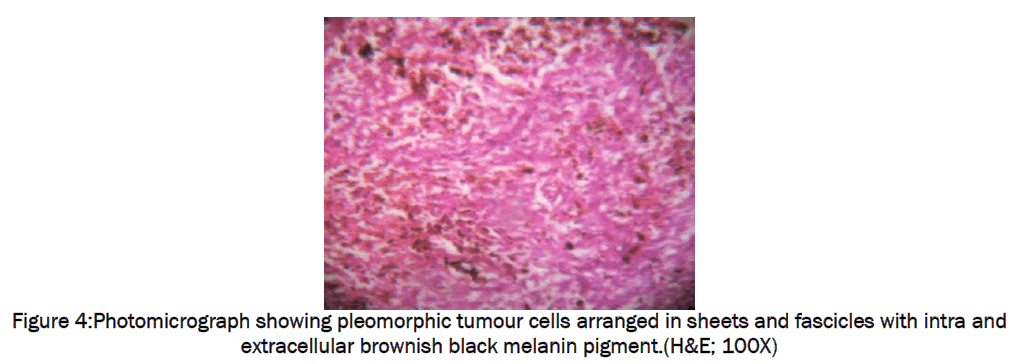 medical-health-sciences-Photomicrograph-showing-pleomorphic