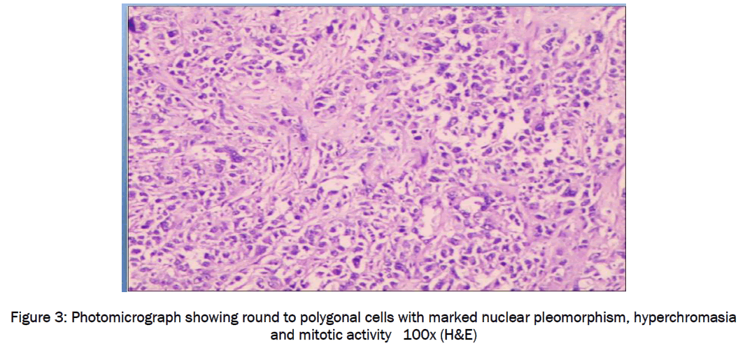 medical-health-sciences-Photomicrograph-showing-round-polygonal