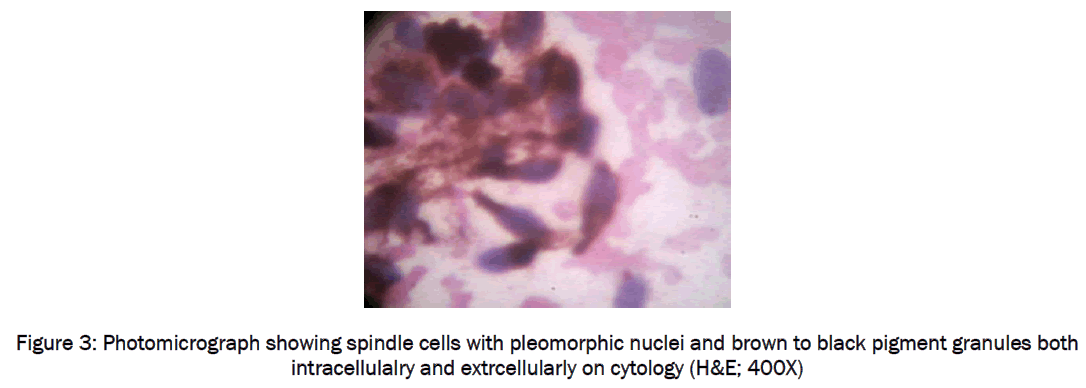 medical-health-sciences-Photomicrograph-showing-spindle