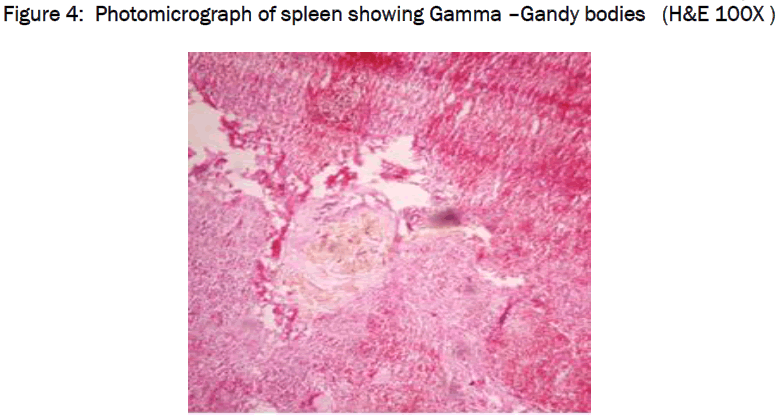 medical-health-sciences-Photomicrograph-spleen-Gamma