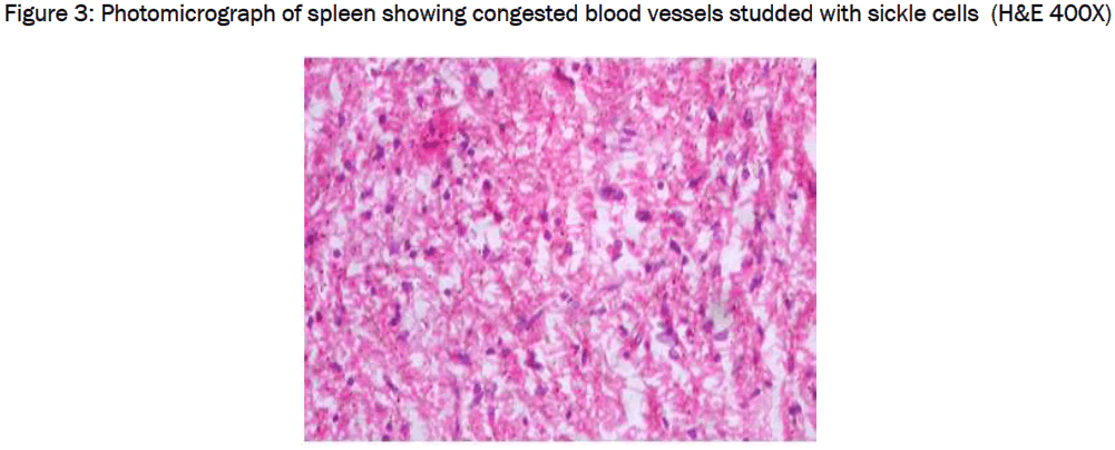 medical-health-sciences-Photomicrograph-spleen-congested