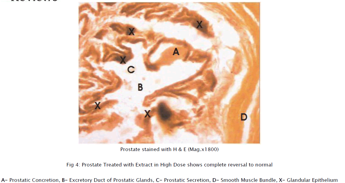 medical-health-sciences-Prostate-Treated-Extract-High