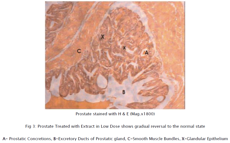 medical-health-sciences-Prostate-Treated-Extract-Low