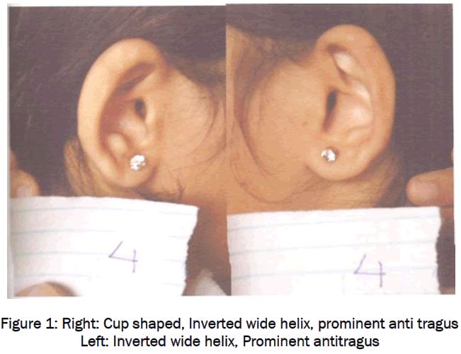 medical-health-sciences-Right-Cup-shaped-Inverted