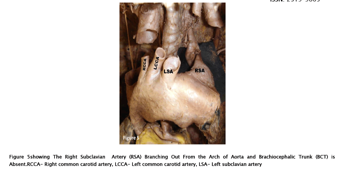 medical-health-sciences-Right-Subclavian-Artery