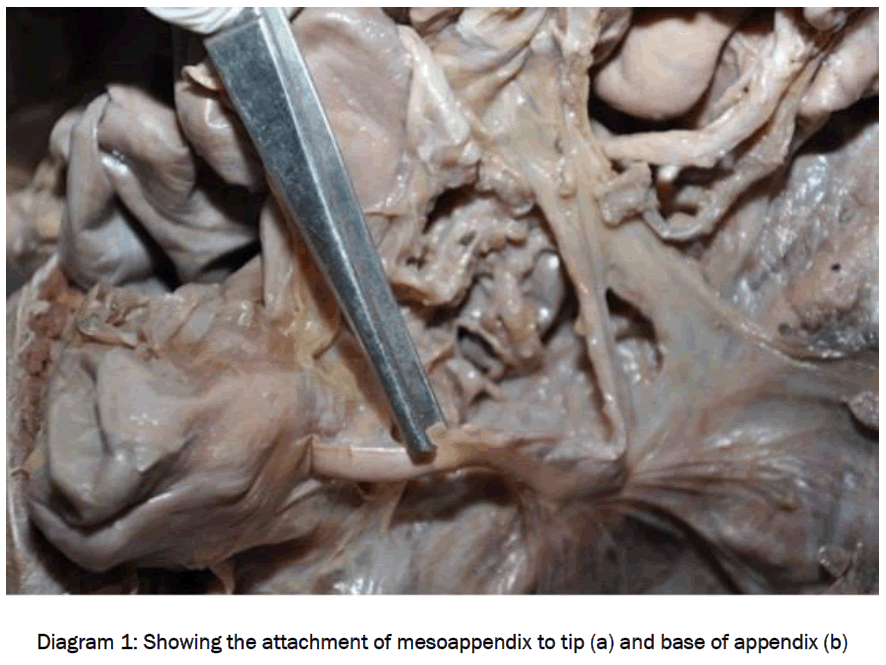 medical-health-sciences-Showing-attachment-mesoappendix