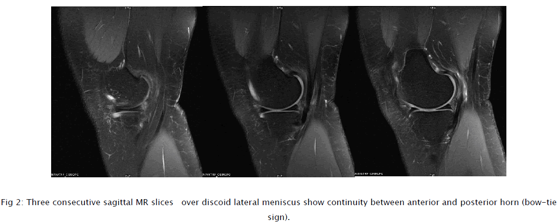 medical-health-sciences-Three-consecutive-sagittal-MR