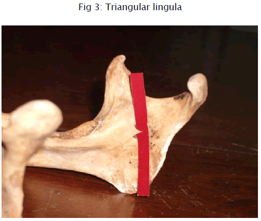 medical-health-sciences-Triangular-lingula