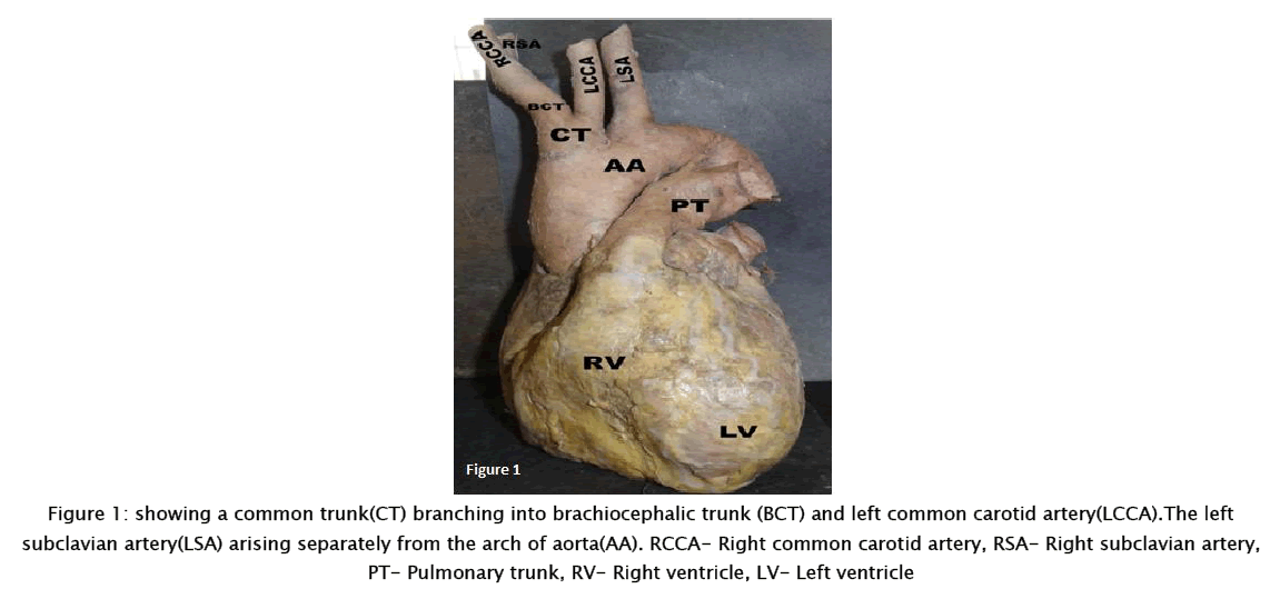 medical-health-sciences-brachiocephalic-trunk