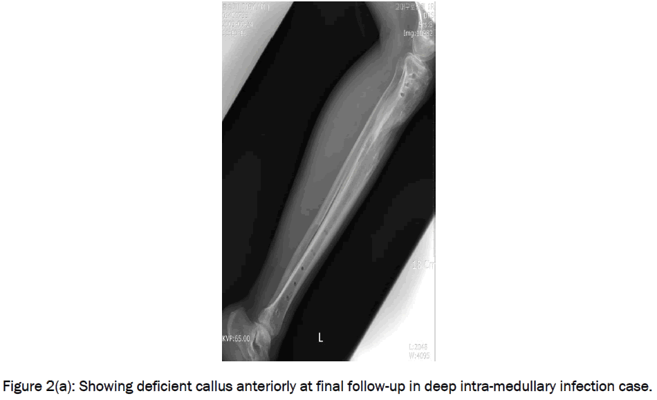 medical-health-sciences-intra-medullary