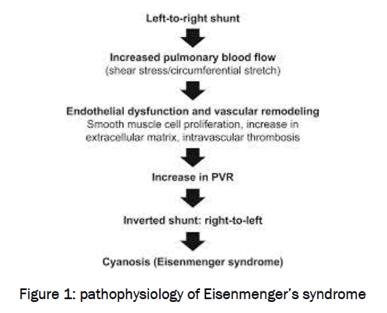 medical-health-sciences-pathophysiology-Eisenmenger-syndrome
